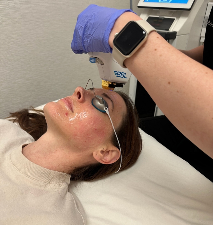 BBL-hero-treatment-available-in-louisville-co