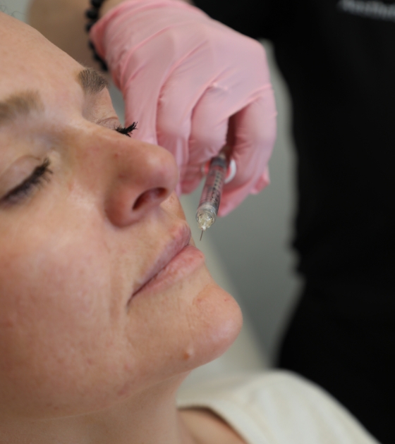 lip-fillers-treatments-louisville-co-1