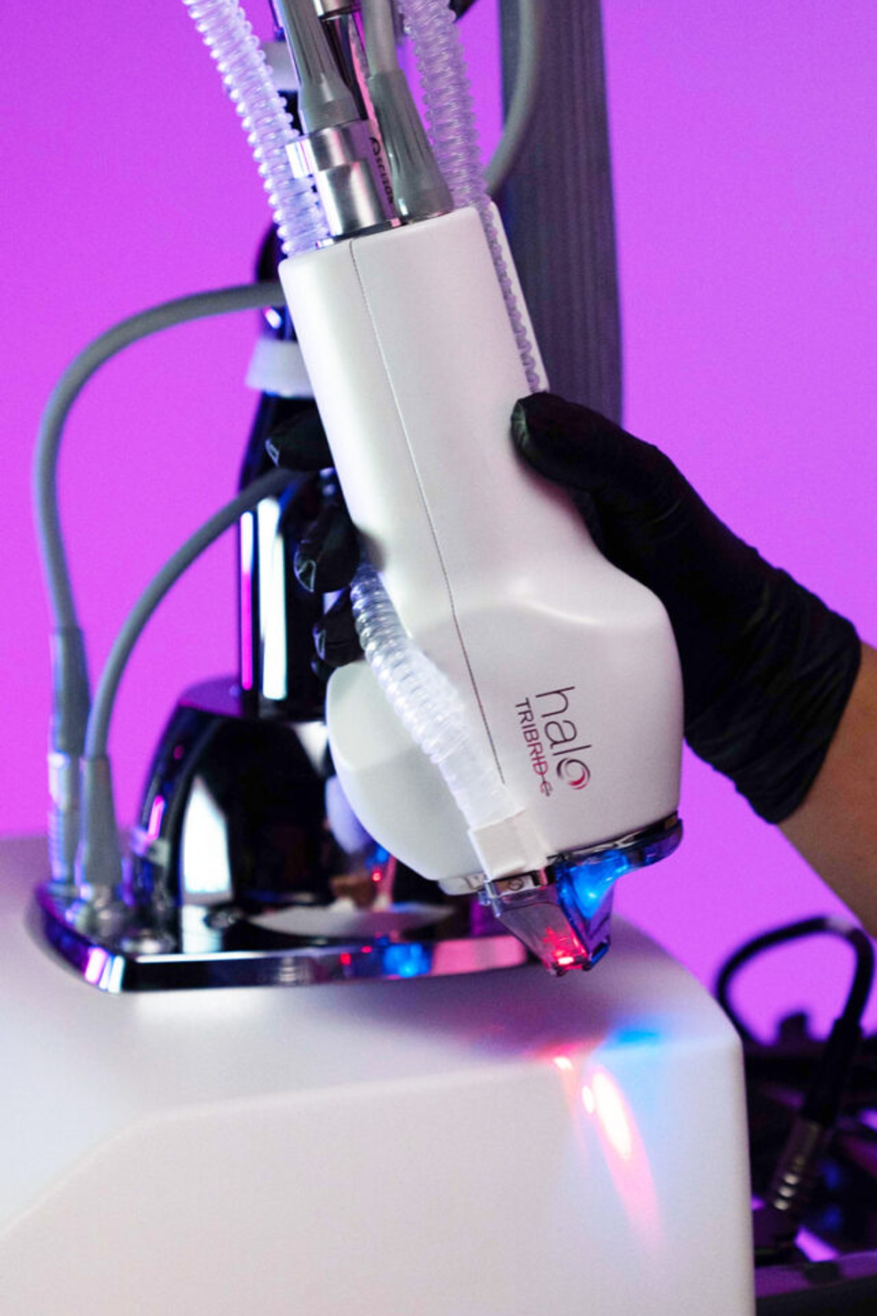 5-questions-halo-treatment-fractional-laser-2