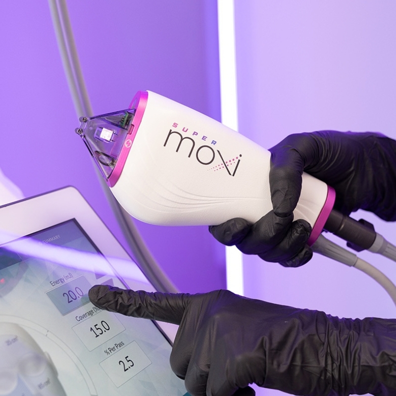 superMOXI-laser-1